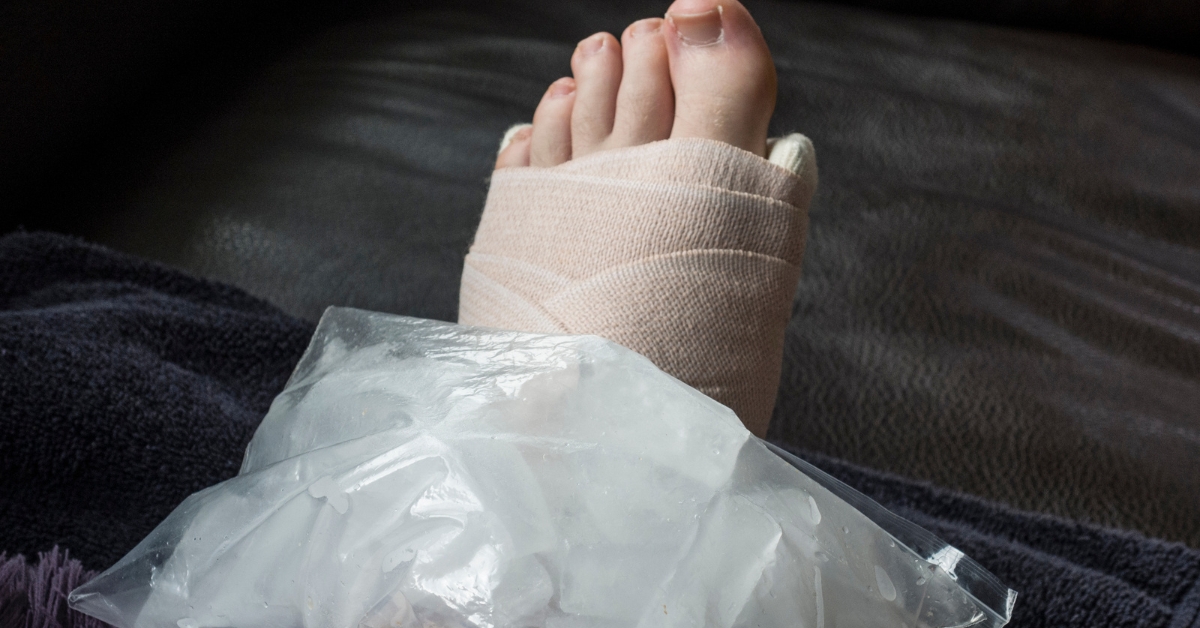sprained foot