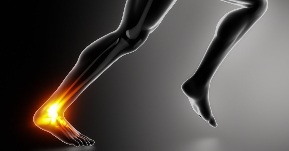 Achilles Tendon Pain From Running